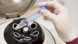 New Study Says Women Are Freezing Their Eggs Because Men Are Unstable
